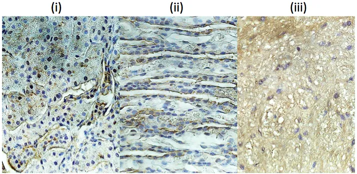 Three further IHC micrographs (i, ii, iii) showing antibody staining patterns in vivoPHIX-fixed tissue