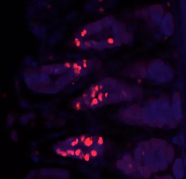 Immunofluorescence micrograph showing red fluorescent signal in blue counterstained tissue