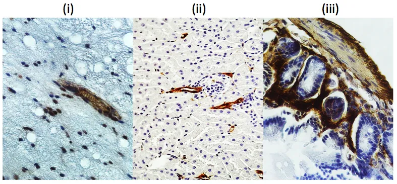 Three IHC micrographs (i, ii, iii) showing brown antibody staining in vivoPHIX-fixed tissue sections
