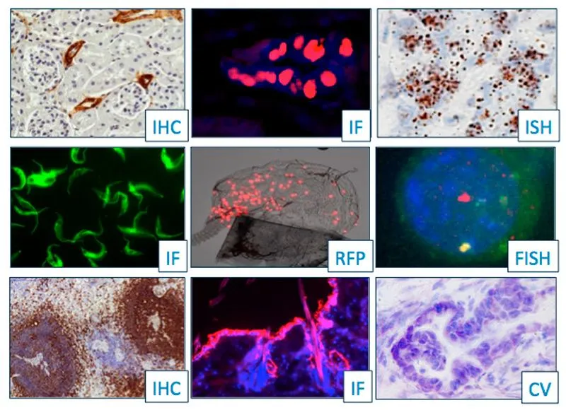 Grid of nine micrographs demonstrating IHC, immunofluorescence, in situ hybridization, RFP, FISH and cytology staining on vivoPHIX-fixed samples