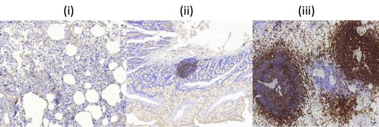 Three additional IHC micrographs (i, ii, iii) showing antibody staining across different tissue regions
