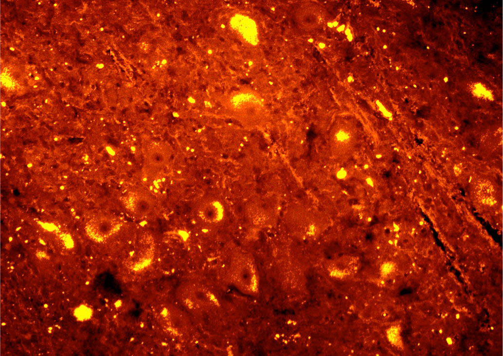 immunofluorescence immunofluorescence